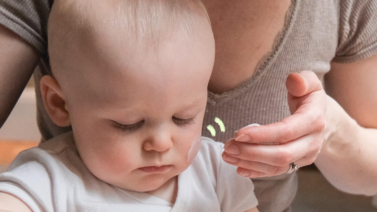 La Peau Sèche sur le Visage des Bébés : Causes, Traitements et Prévention